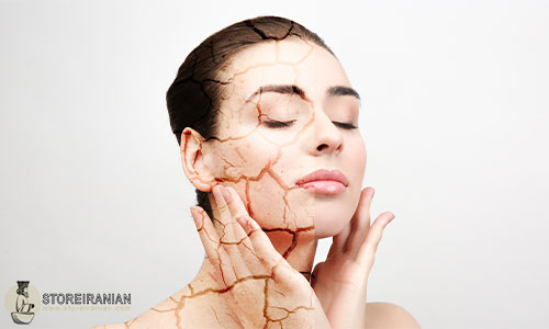 پوست خشک: ویژگی ها و مراقبت از آن